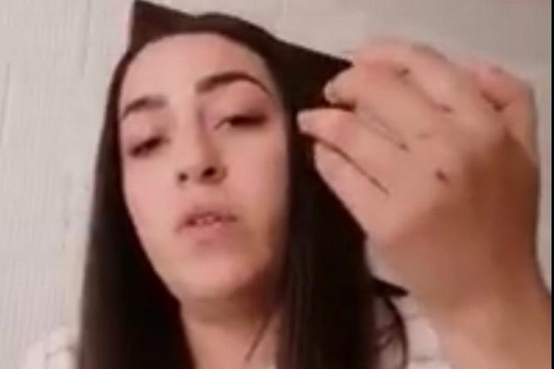 Pitbull ataca a mujer en Veracruz y le destroza las manos 