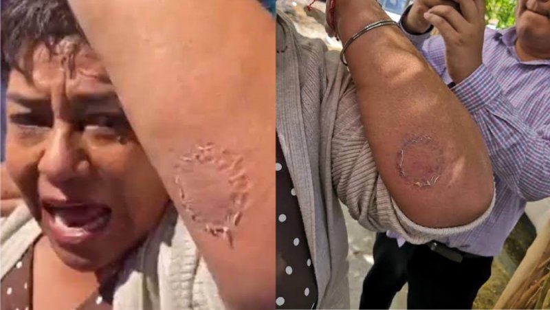 Diputadas de Baja California se agreden a mordidas