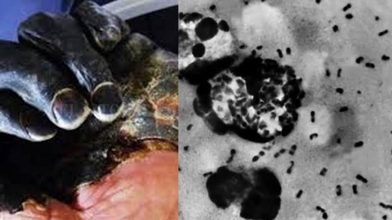 Decretan alerta Nivel 3 en China por PESTE NEGRA 