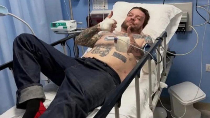 “Voy a morir”: Corey, del Precio de la Historia, pide donaciones tras accidente