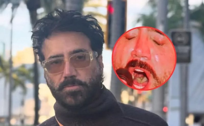 Alejandro Fernández explota tras ser cuestionado por extraño aspecto de su lengua 