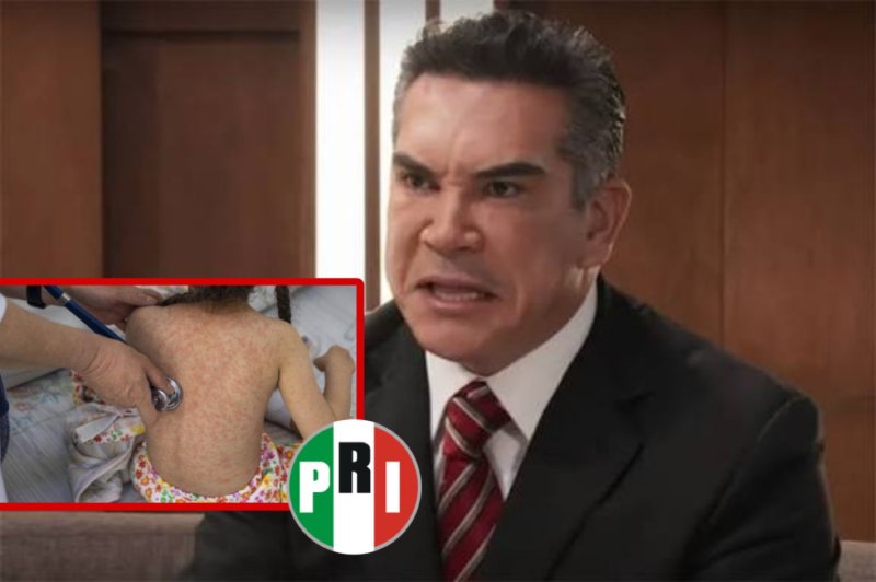Alejandro Moreno politiza brotes de sarampión y arremete contra el gobierno de Sheinbaum