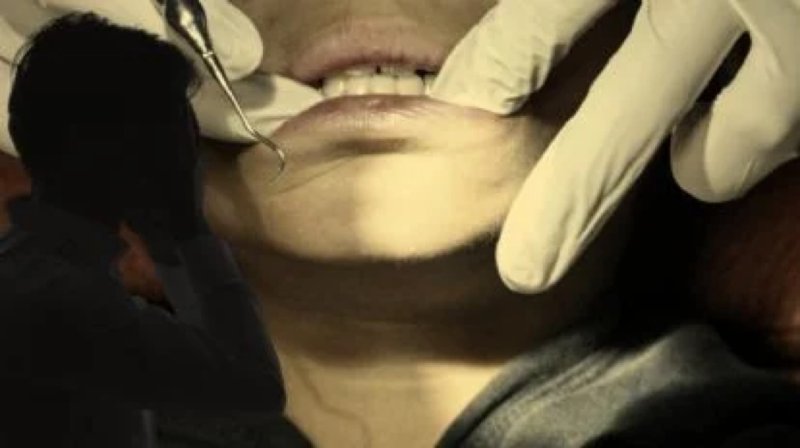 Hombre muere tras recibir una inyección en el dentista por una muela picada 