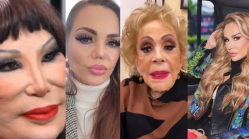 9 famosos que se veían mejor sin cirugías y que sufrieron un daño devastador