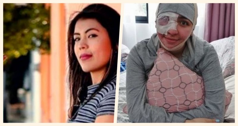 Dan de alta a Elenea Ríos, saxofonista atacada con ácido por ex diputado del PRI