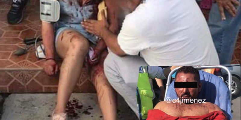 Sujeto trata de matar a su exesposa en presencia de su hija de 2 años