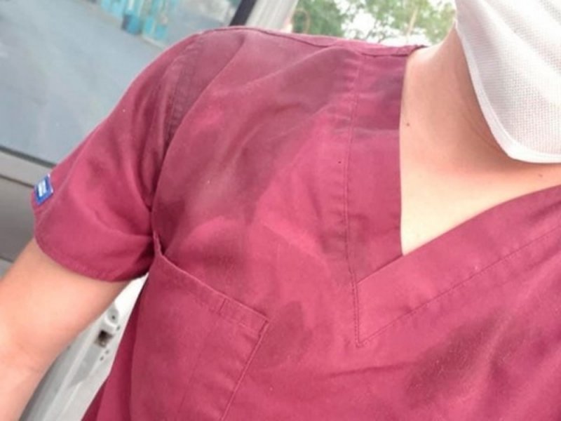 Le arrojan CAFÉ HIRVIENDO a ENFERMERO de Guadalajara