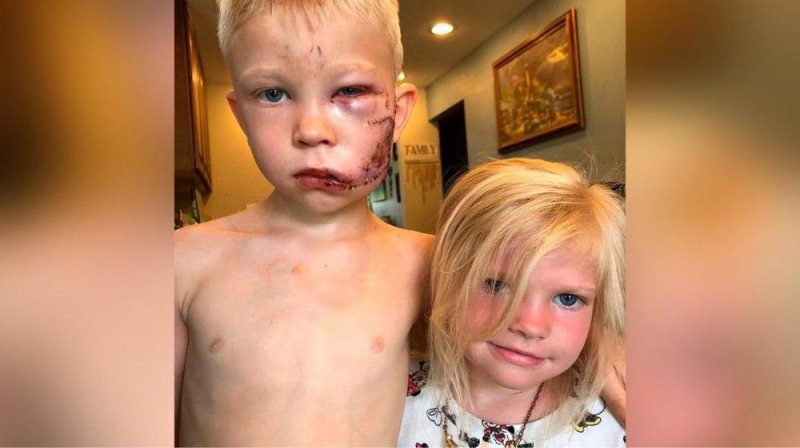 Valiente NIÑO de 6 años salva a su HERMANITA de ser MORDIDA por un perro