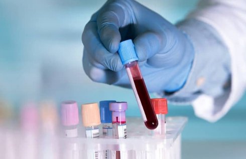 Descubren análisis de SANGRE que podría DETECTAR cáncer 4 años antes de que aparezca