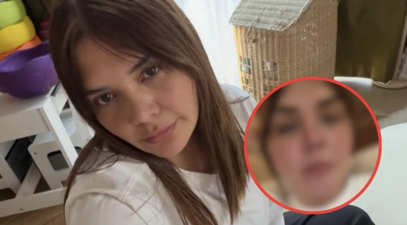 Yuridia genera preocupación tras sufrir una quemadura en el rostro: “Me empezó a arder”  