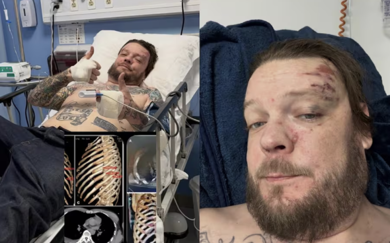 Corey Harrison, de ‘El precio de la historia’, sufre grave accidente en México y pide apoyo