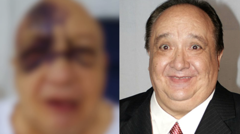 ¿Cuál es el estado de salud del comediante Luis de Alba? resultó lesionado tras fuerte accidente