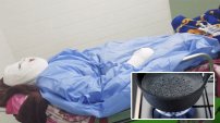 Deja ciega, muda y desfigurada a su esposa tras verterle aceite hirviendo mientras dormía