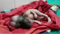 Nace bebé con tres cabezas, un caso extrañísimo en el mundo. 