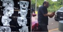 Le clavan cuchillo en el ojo tras pelearse por un estacionamiento en Veracruz. (VIDEO)