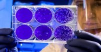 Estudio revela que la luz ultravioleta ELIMINA el Covid-19